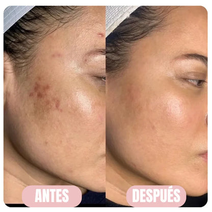 ThePiro™ - Mascarilla Nocturna de Colágeno