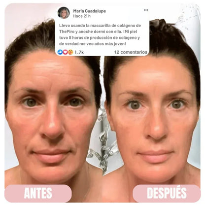 ThePiro™ - Mascarilla Nocturna de Colágeno
